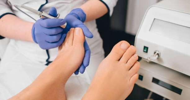 How to treat a fungal nail infection