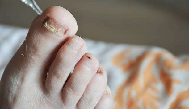 How to Create a Healthy Toenails Routine