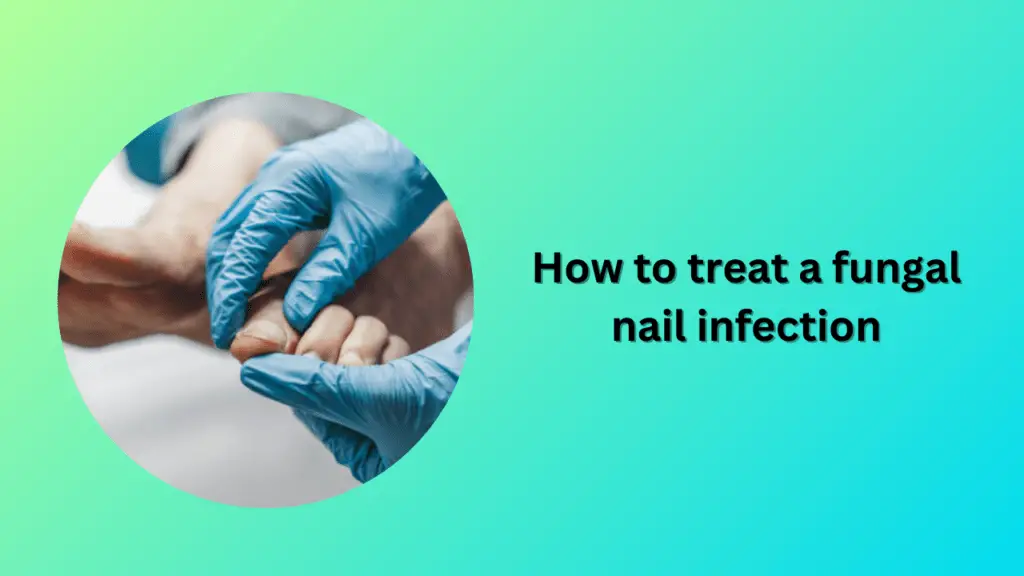 How to treat a fungal nail infection