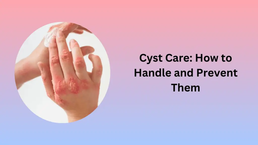 Cyst Care: How to Handle and Prevent Them